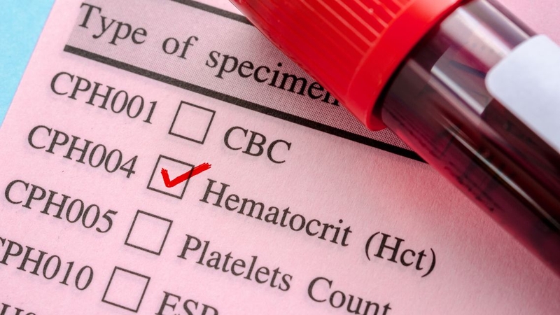 Cô đặc máu&nbsp;thường được phản ánh qua chỉ số hematocrit (Hct) tăng cao
