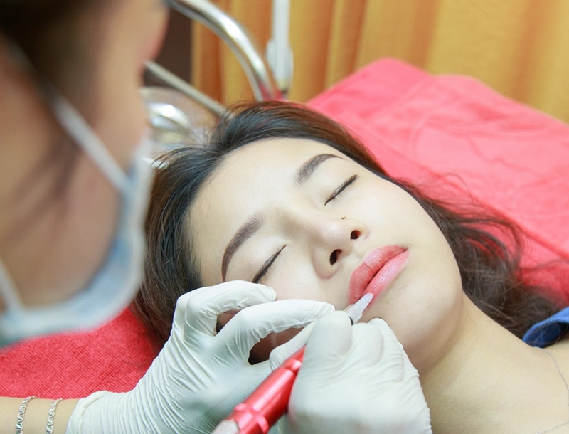 cơ địa sẹo lồi có xăm môi được không 2