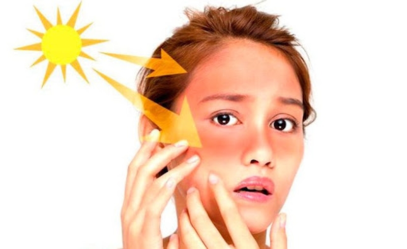 Có điều trị được tàn nhang do thay đổi nội tiết tố hay không 3