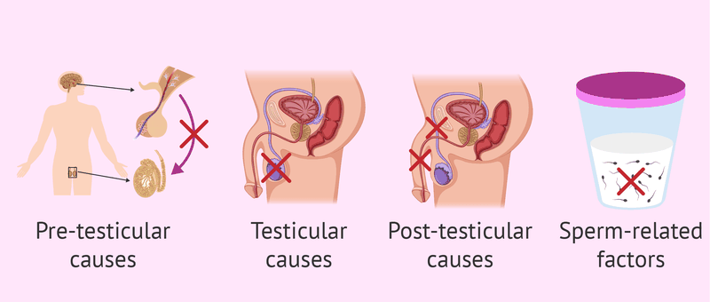 Cố gắng để có thai? Nguyên nhân và cách điều trị vô sinh 4