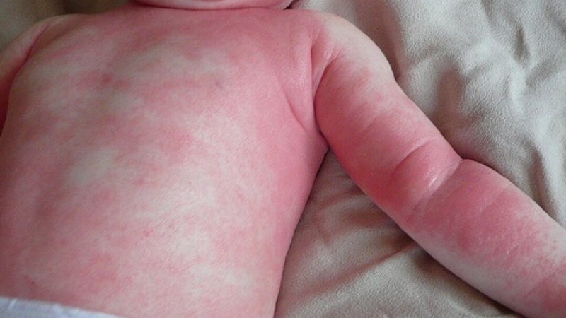 Cỏ máu – cây gỗ biết “chảy máu”&nbsp;5.jpg