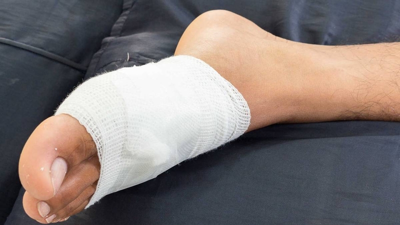 Bí quyết xử lý lở loét da mau lành, không để lại sẹo 3