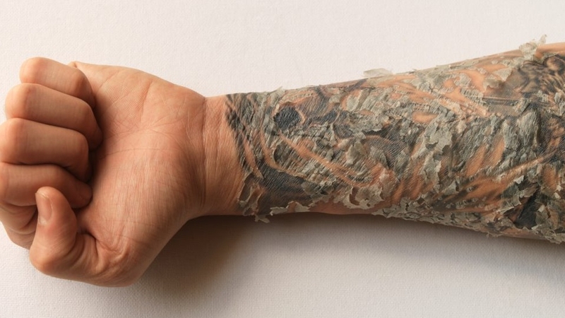 Có nên bóc vảy hình xăm không? 2