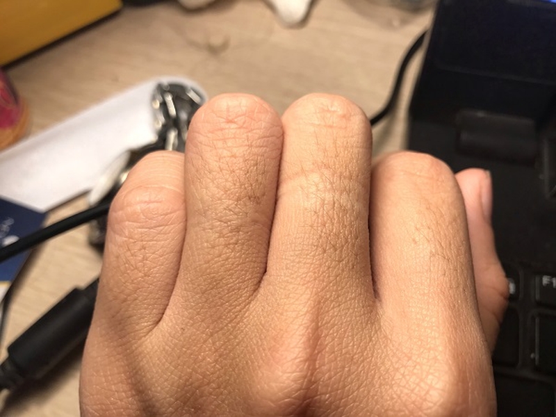 Có nên cạo lông ngón tay không 1