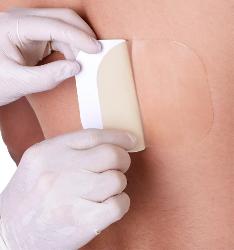 Góc giải đáp: Có nên dán cao hút mủ vào vết thương không? 2