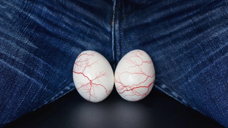 Tinh hoàn nhân tạo giúp duy trì thể tích và độ căng tự nhiên của bìu, từ đó hạn chế các biến dạng thứ phát