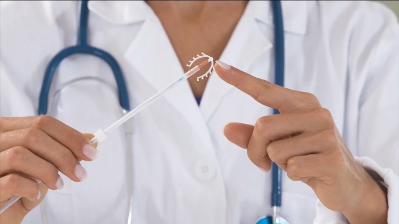 Có nên đặt vòng tránh thai nội tiết không? 1