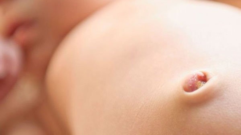 Có nên đeo băng rốn cho trẻ sơ sinh? Những lưu ý khi chăm sóc rốn cho trẻ sơ sinh 3