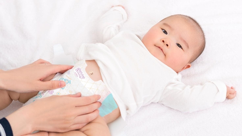 Có nên đeo băng rốn cho trẻ sơ sinh? Những lưu ý khi chăm sóc rốn cho trẻ sơ sinh 5