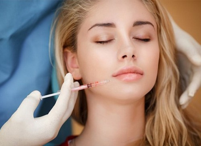 Có nên độn cằm bằng mỡ tự thân hay không?1