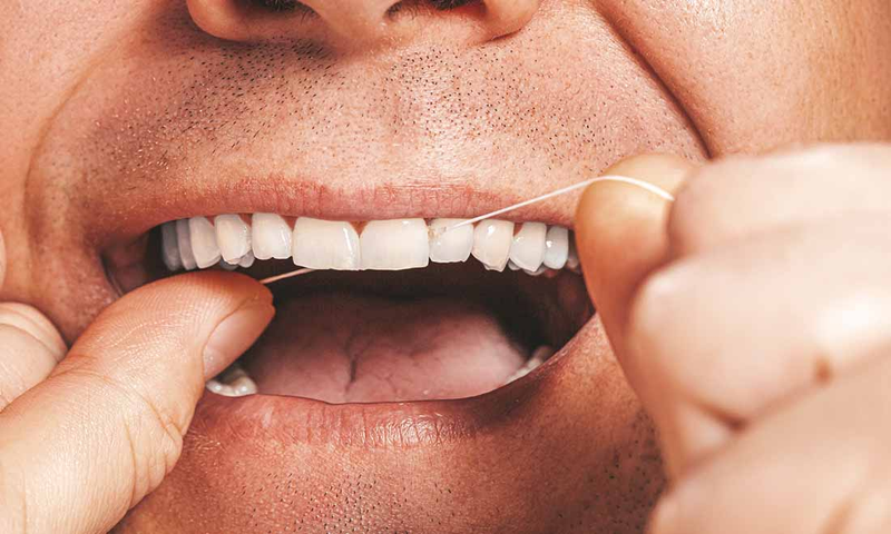 Có nên dùng chỉ nha khoa thường xuyên hay không?3