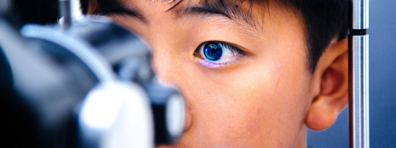 Có nên mổ mắt cận không? Tìm hiểu các phương pháp mổ cận 5