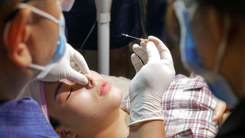 Có nên nâng mũi không? Nâng mũi có hại về sau không? 2