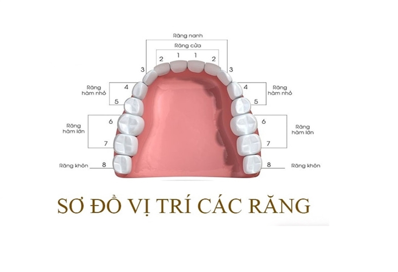 Giải đáp thắc mắc: Có nên nhổ răng số 4 để niềng không 1