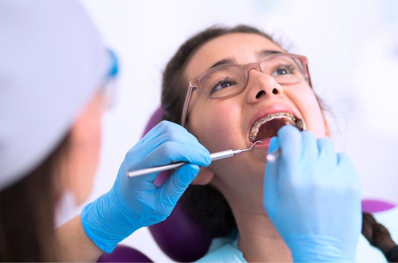 Giải đáp thắc mắc: Có nên nhổ răng số 4 để niềng không 3