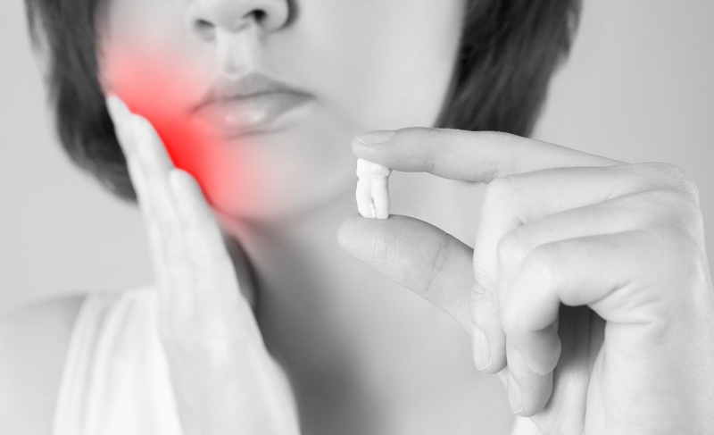 Có nên nhổ răng số 8 hàm dưới không 3