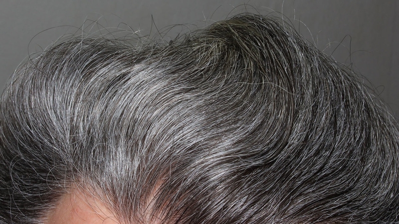 co-nen-nho-toc-bac-su-that-ban-can-biet 1