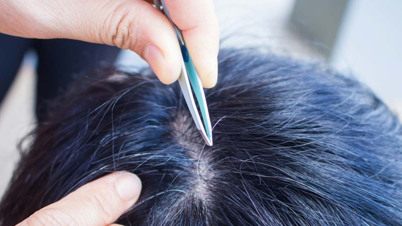 co-nen-nho-toc-bac-su-that-ban-can-biet 2