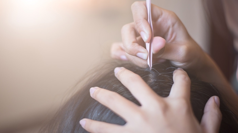 co-nen-nho-toc-bac-su-that-ban-can-biet 3