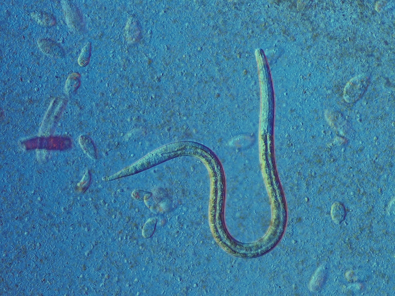 Có nên tẩy giun cho trẻ dưới 2 tuổi hay không?2