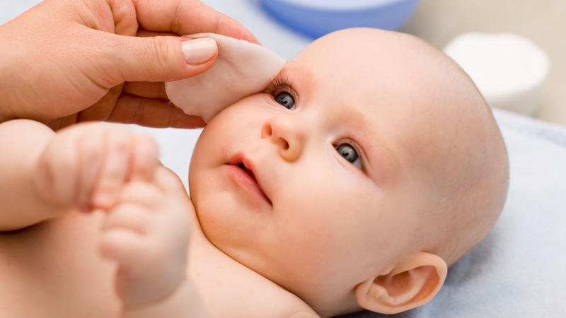 Có nên thông tuyến lệ cho trẻ sơ sinh hay không? 2