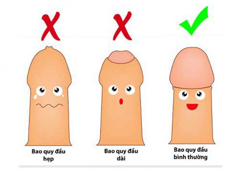 Nam giới có nên tuột bao quy đầu khi mặc quần hay không?