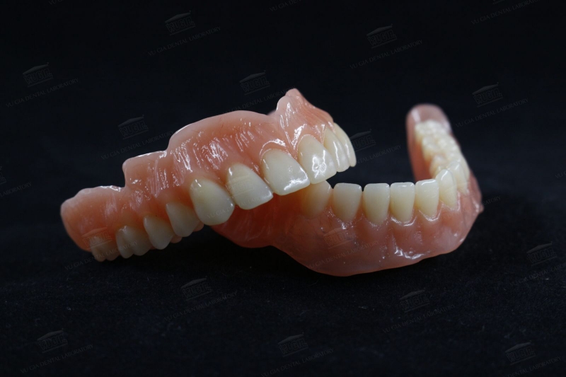 Có răng giả có niềng răng được không?2