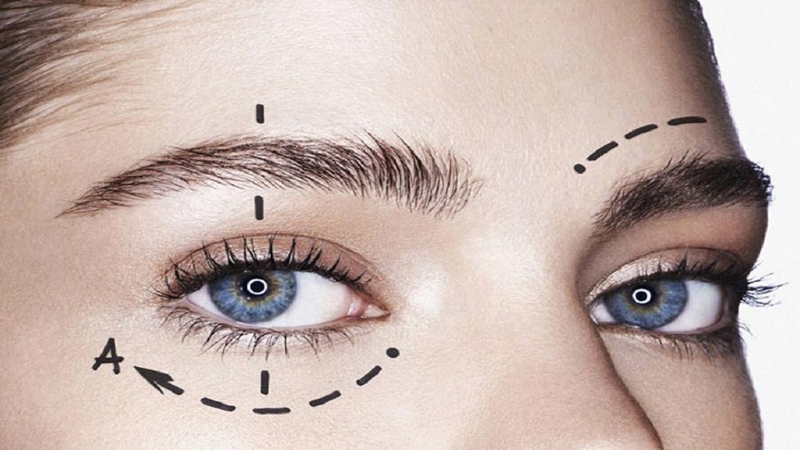 Sau khi nâng lông mày, chỉ lau nhẹ vùng da quanh mắt bằng bông hoặc băng vệ sinh thấm nước muối