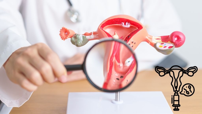 co-the-lam-iui-may-lan-thi-thanh-cong-cau-tra-loi-khien-ban-bat-ngo 1