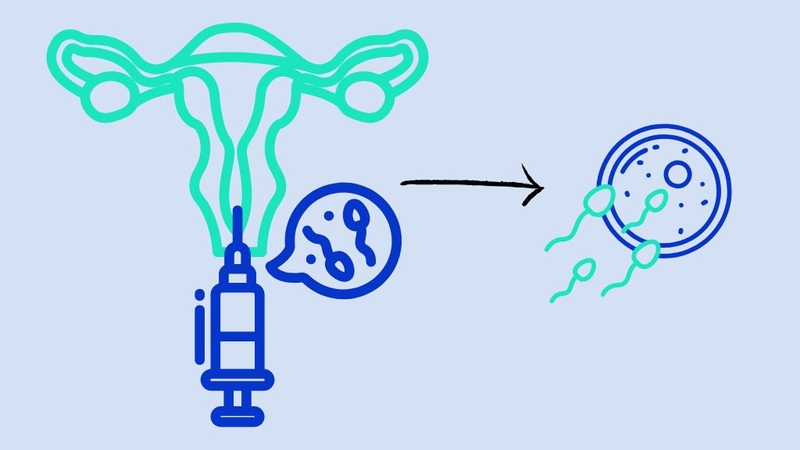 co-the-lam-iui-may-lan-thi-thanh-cong-cau-tra-loi-khien-ban-bat-ngo 2