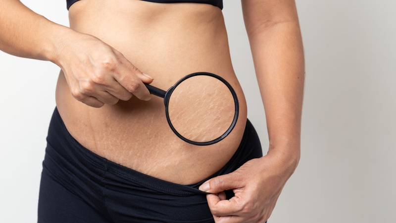 Cơ thể phụ nữ sau sinh thay đổi như thế nào? 3