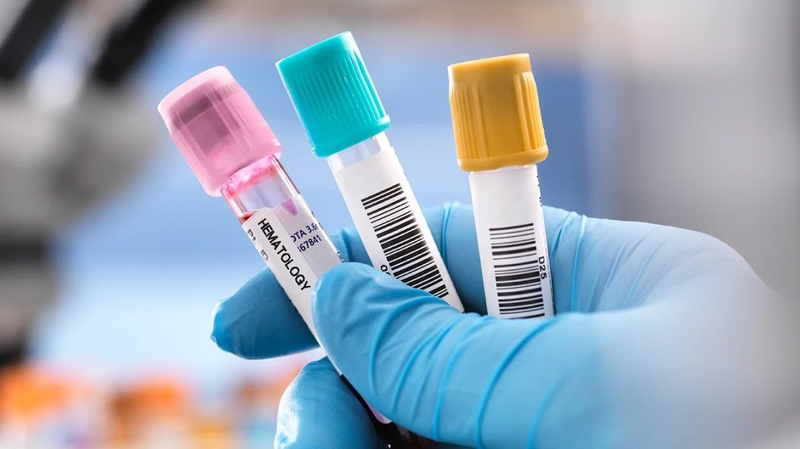 Có thể xét nghiệm ADN anh em cùng cha khác mẹ không? 3