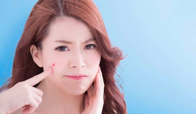 Cồi mụn là gì? Cách gom cồi mụn nhanh chóng tại nhà 1