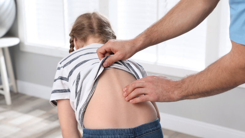 Còi xương là gì? Dấu hiệu, nguyên nhân, chẩn đoán và điều trị 1