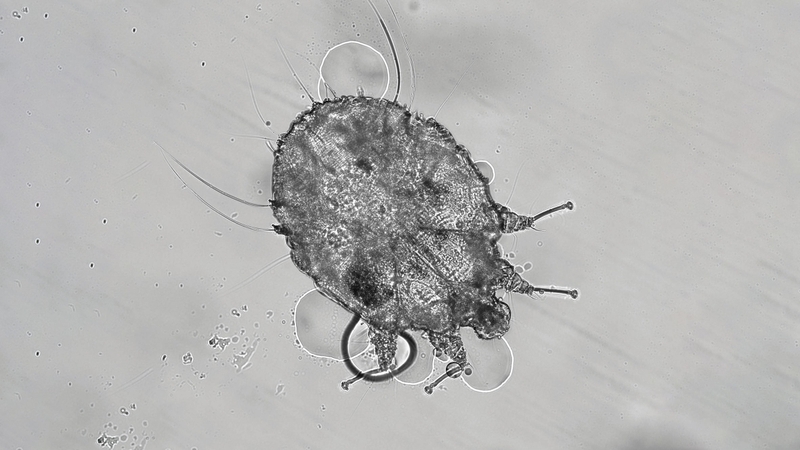 Con cái ghẻ là gì? Có nguy hại đến sức khỏe không? 1