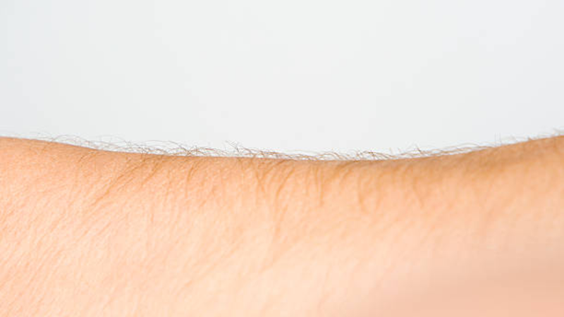 Con gái nhiều lông tay thì sao? Những điều phái nữ nên biết 1