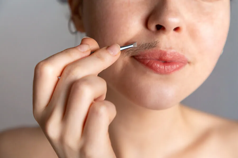 Con gái nhổ ria mép có sao không? 1