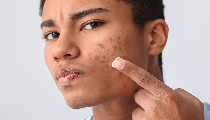 Con trai có nên dùng kem dưỡng da? Cách dưỡng da phù hợp với con trai 2