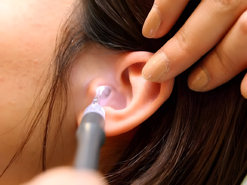 Côn trùng chui vào tai làm sao cách nhận biết và xử trí? 1