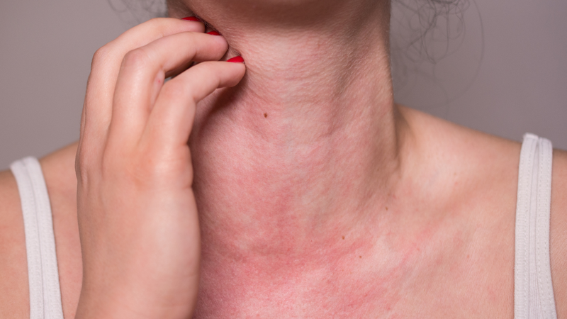 Sữa ong chúa là gì? Các tác dụng của sữa ong chúa với sức khỏe 4