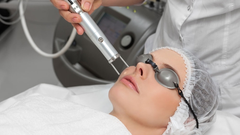 Công nghệ laser Q-switched và tất tần tật những điều cần biết 1