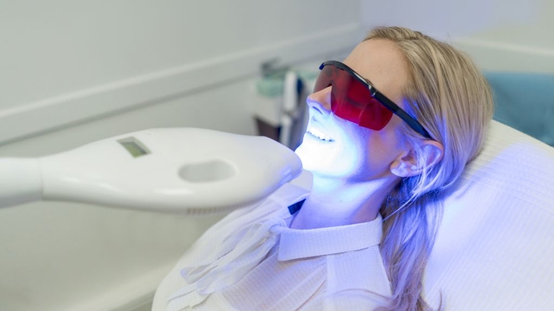 Công nghệ tẩy trắng răng laser whitening có hiệu quả không? 2