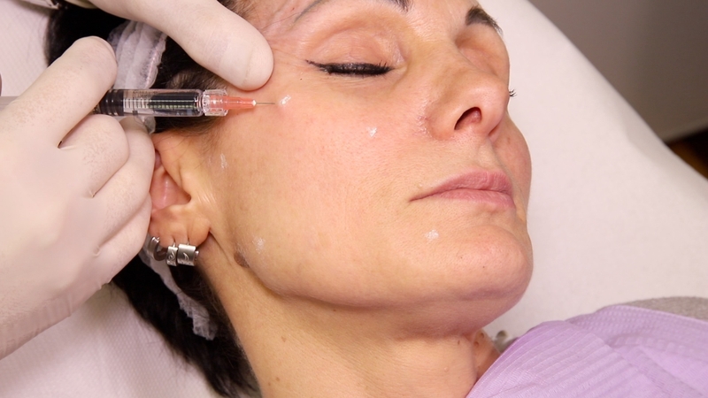 Công nghệ tiêm bap 5 điểm trong thẩm mỹ -2