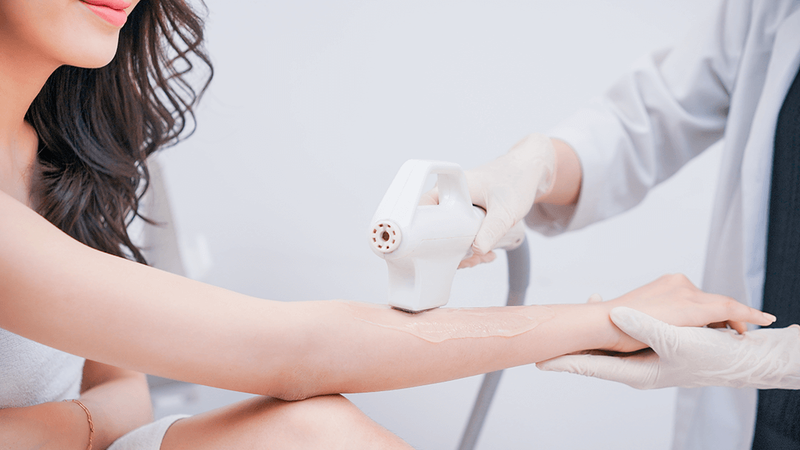 Công nghệ triệt lông DPL là gì? Có hiệu quả không? 2