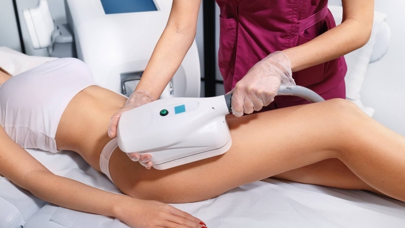 Cryolipolysis là gì? Cơ chế hoạt động và quy trình thực hiện 1