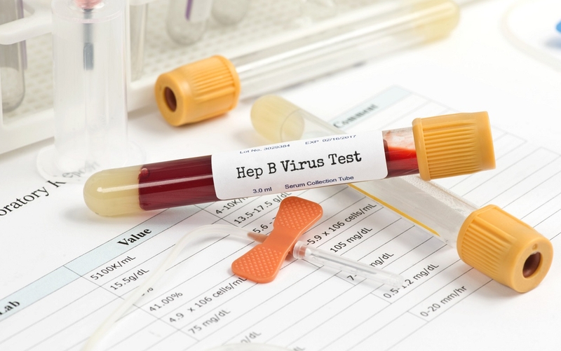 Csbt là gì? Kết quả xét nghiệm dương tính và âm tính có ý nghĩa gì? 4