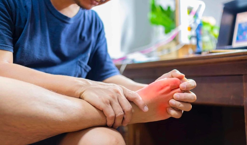 Củ bình vôi chữa bệnh gút có hiệu quả không? Cách sử dụng và lưu ý 1