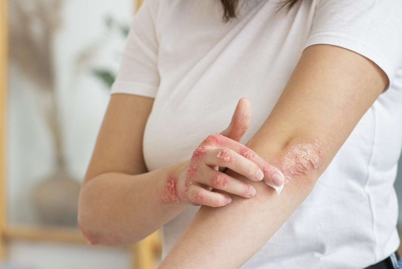 Củ ngải bún: Những công dụng ít người biết 3