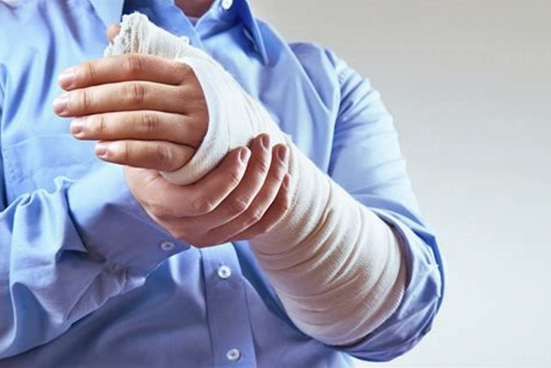 Cụ thể kế hoạch chăm sóc bệnh nhân gãy xương cánh tay 2