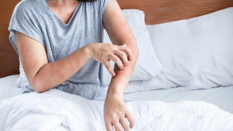 Cúc la mã có thể gây dị ứng ở người nhạy cảm với các loài thực vật họ Cúc